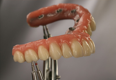 haupt-dental-lab-immediate-function-sm